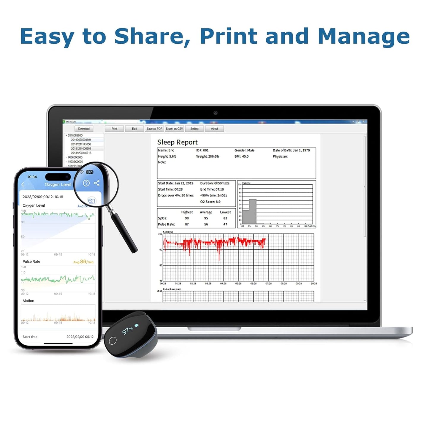 Wellue O2Ring Oxygen Monitor with Vibration Reminder