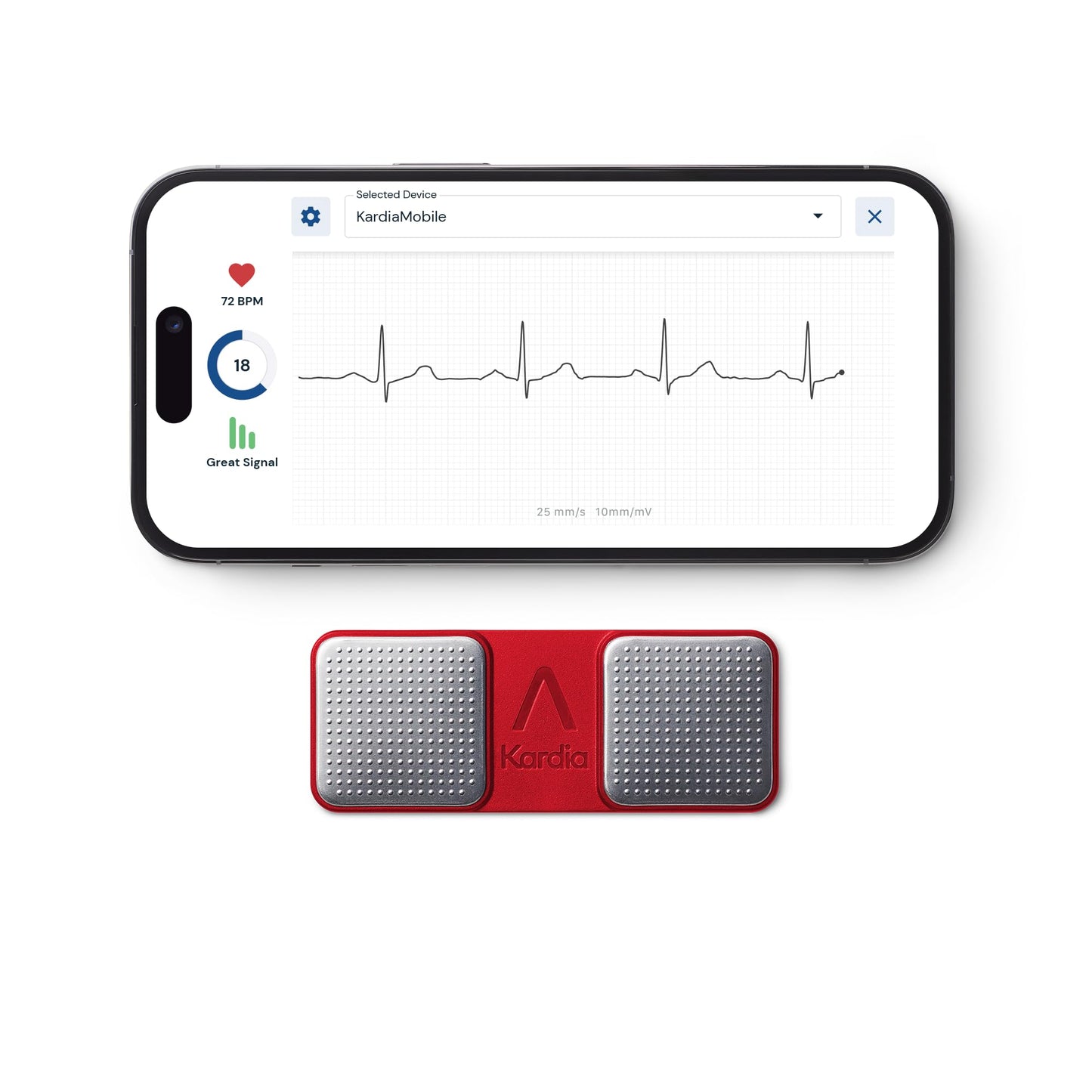 KardiaMobile 1-Lead Personal EKG Monitor – Record at Home – Detects AFib & Irregular Arrhythmias – Easy Results in 30 Seconds – Works w/Most Smartphones
