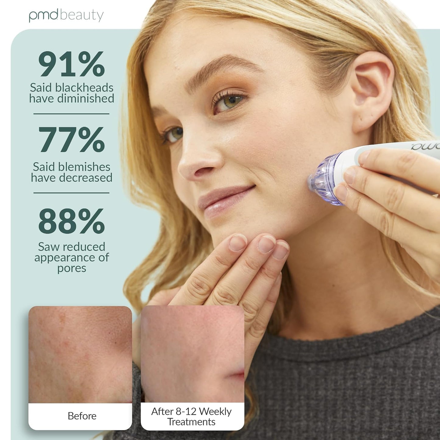 PMD Personal Microderm Elite Pro